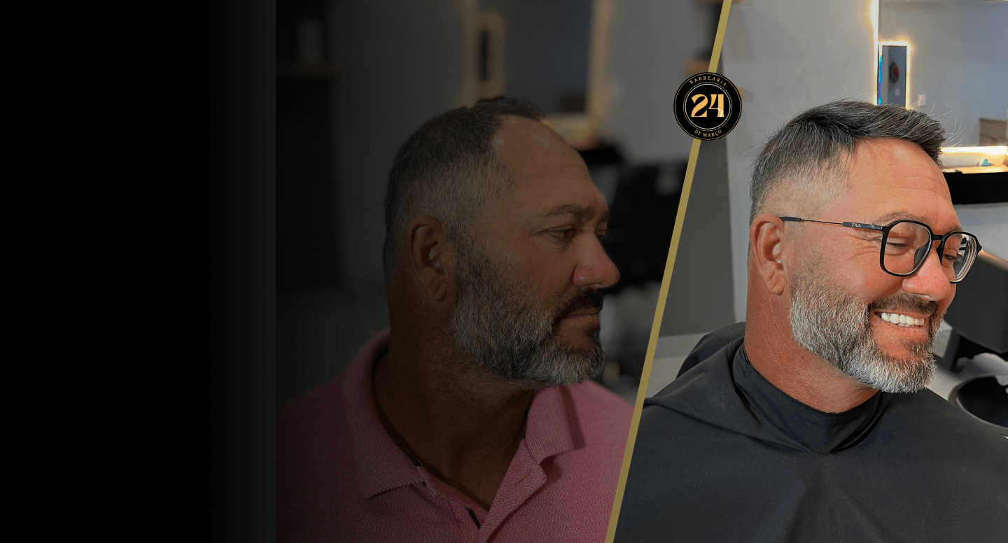 Resultado de prótese capilar no Studio 24 de Março